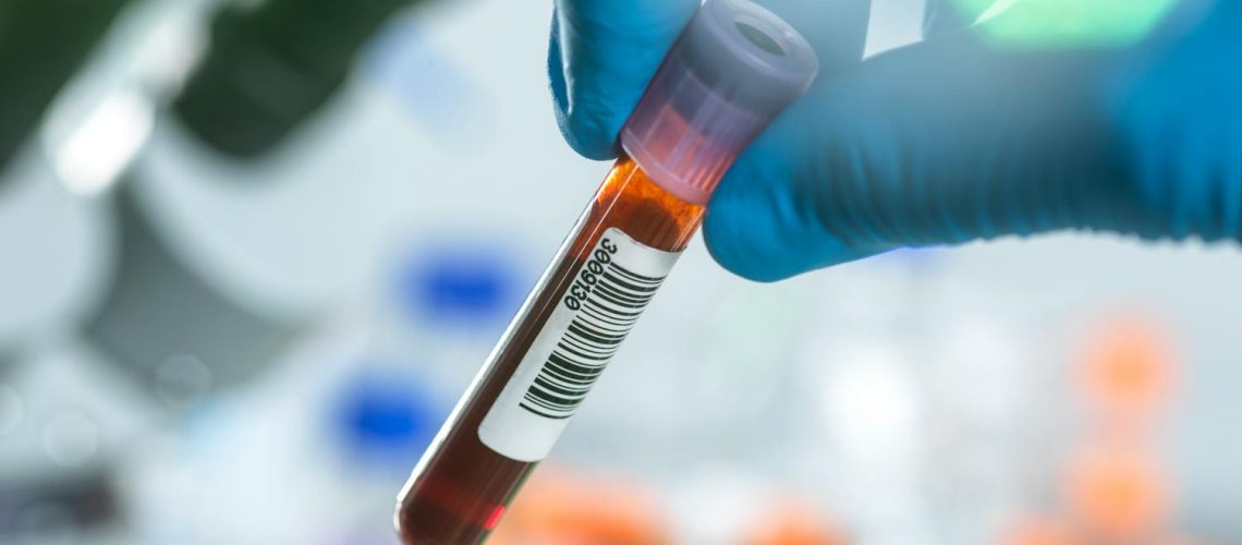 Pourquoi votre médecin prescrit une analyse des plaquettes ? Pourquoi votre médecin prescrit une analyse des plaquettes ?